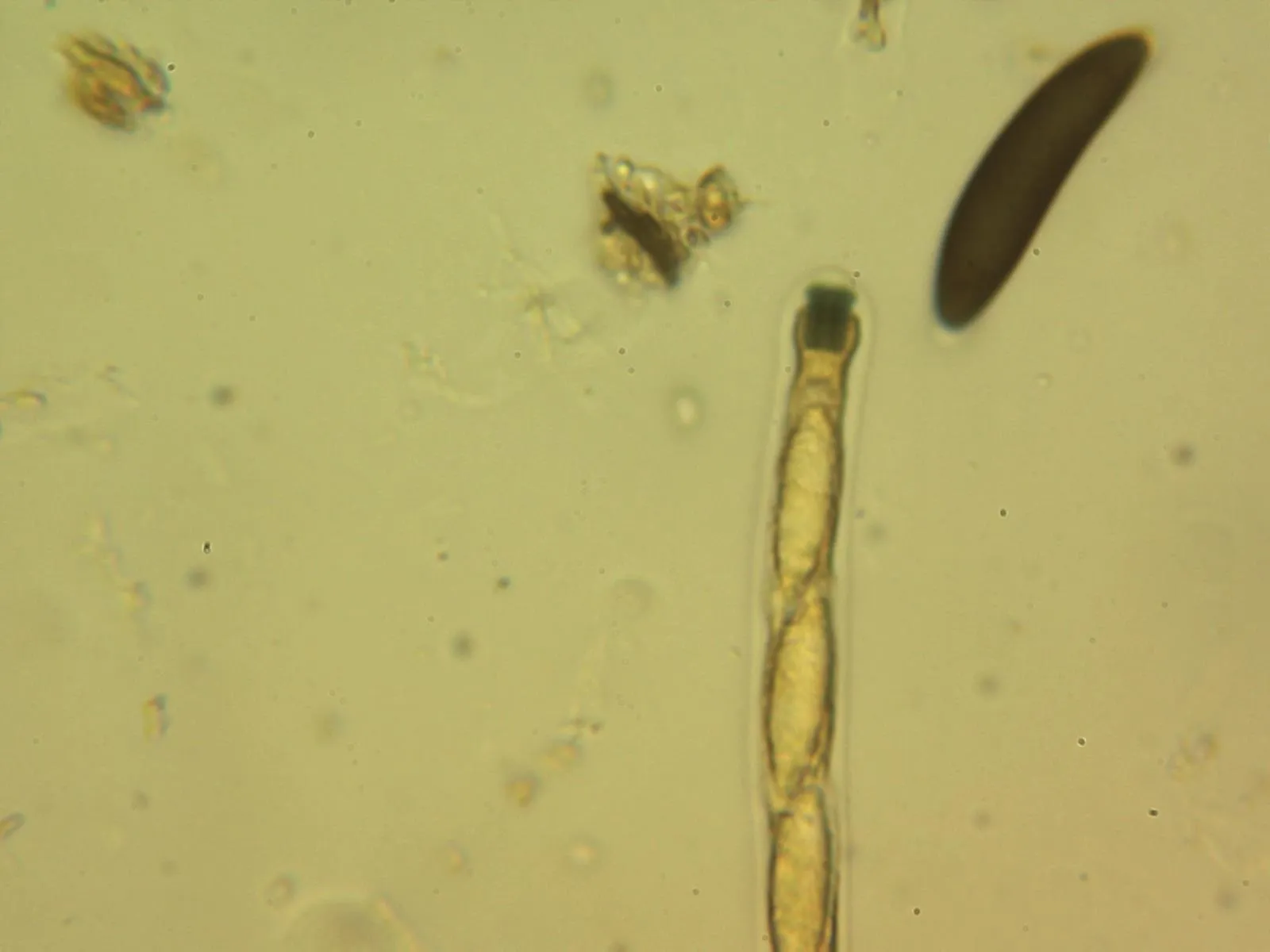 Microscopía de Rosellinia britannica - 10 - Asca Melzer
